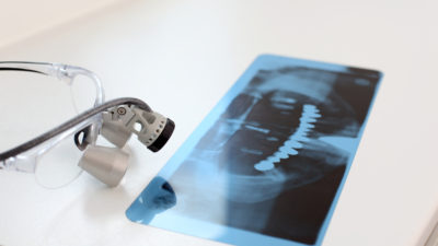 Qué es la ortopantomografía y para qué sirve