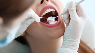 Microabrasión dental