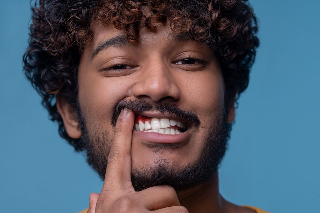 hombre con encías inflamadas