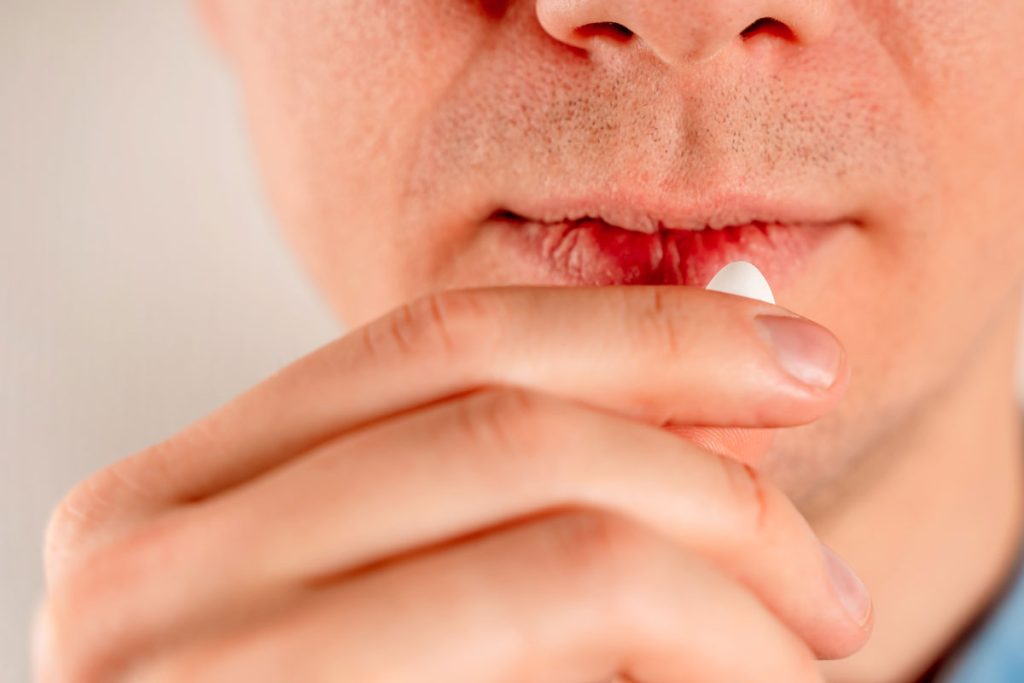 Tratamientos disponibles para aliviar las boqueras