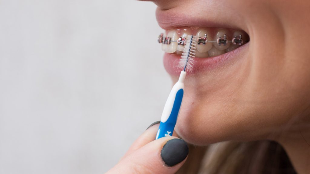 cepillos interdentales