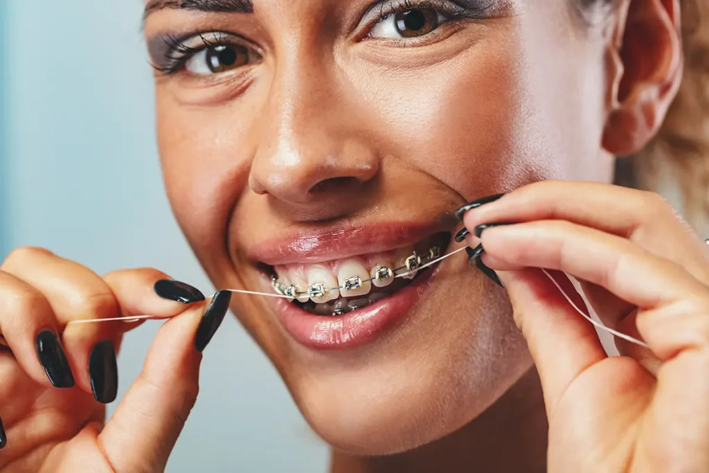 mujer limpiando sus brackets para lucir sonrisa en verano