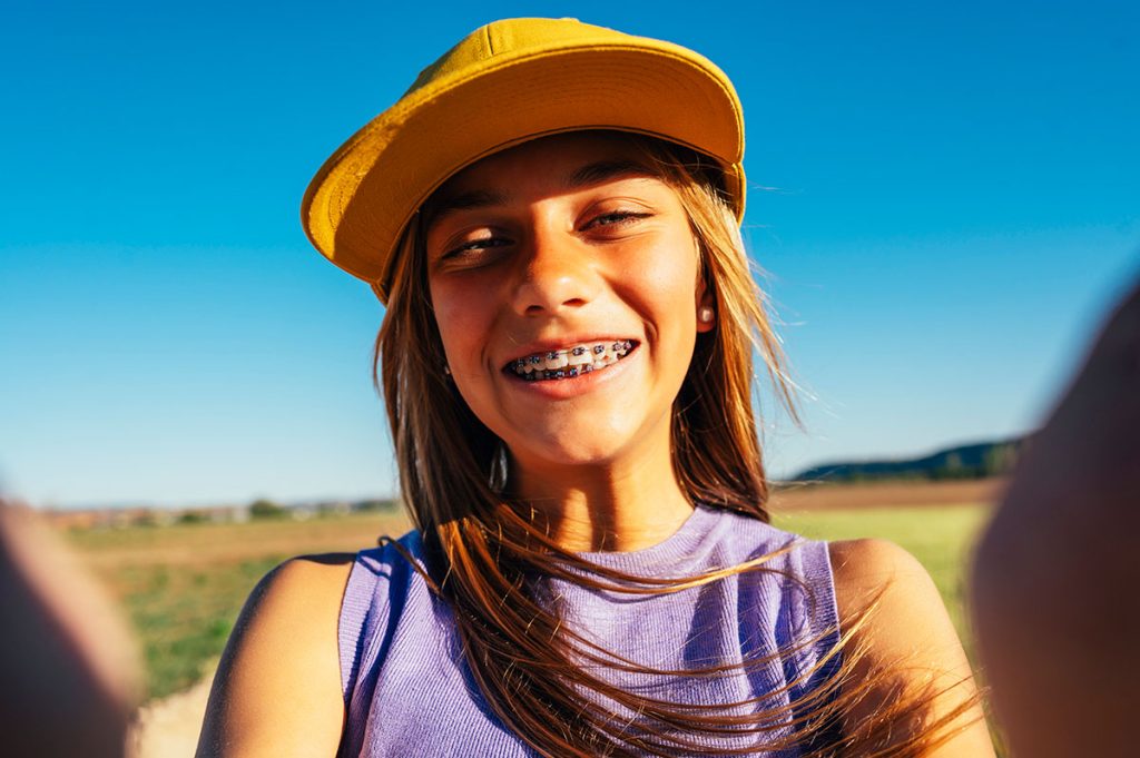 Cómo cuidar brackets y alineadores en verano