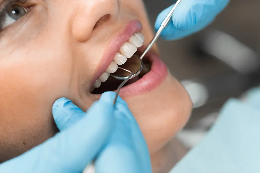 mujer realizándo un chequeo de periodontitis