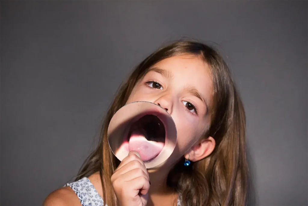 Lengua de fresa: causas y cómo actuar