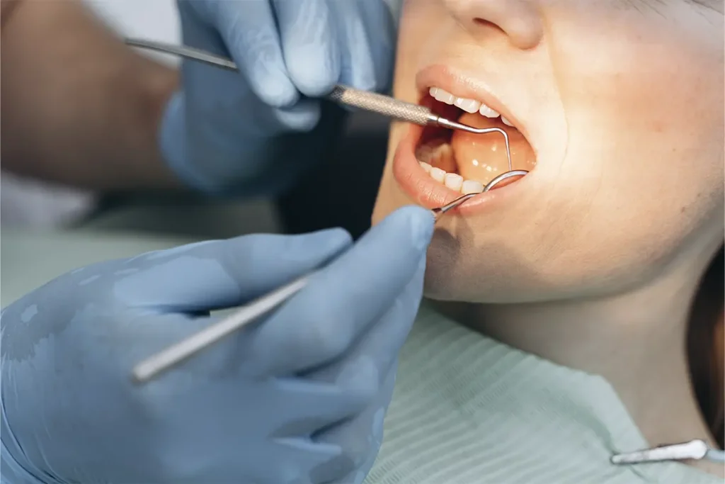 Que es torus mandibular y como tratarlo