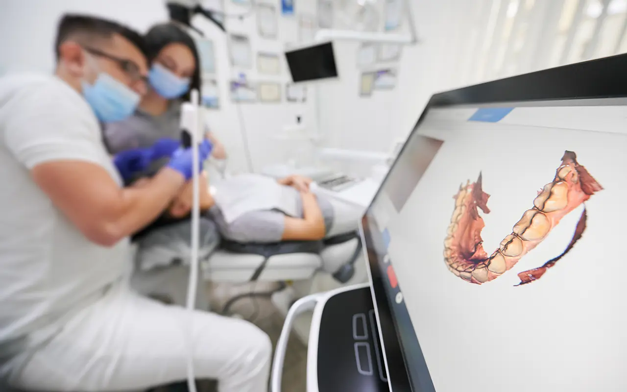 escaner intraoral 3d