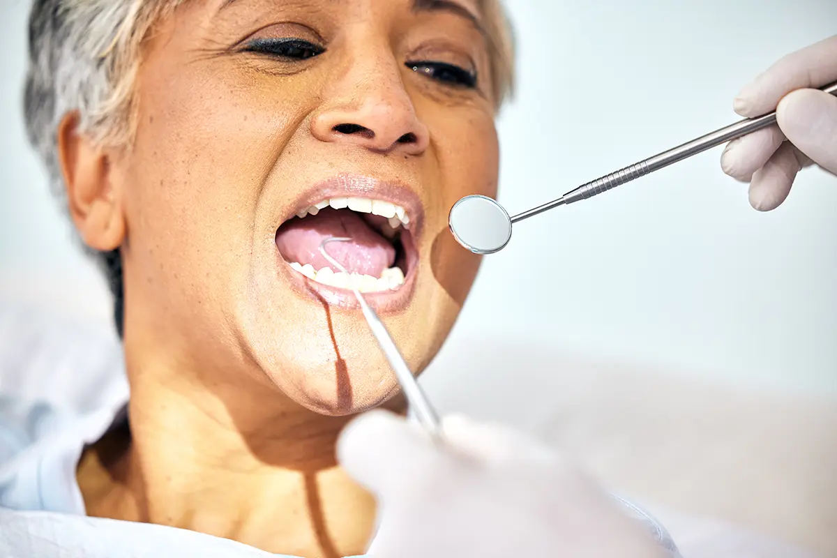 salud bucodental en la menopausia